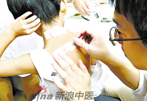 灸法的種類(lèi)  你知道多少？