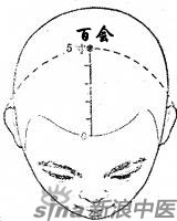 艾灸百會(huì )治耳性眩暈