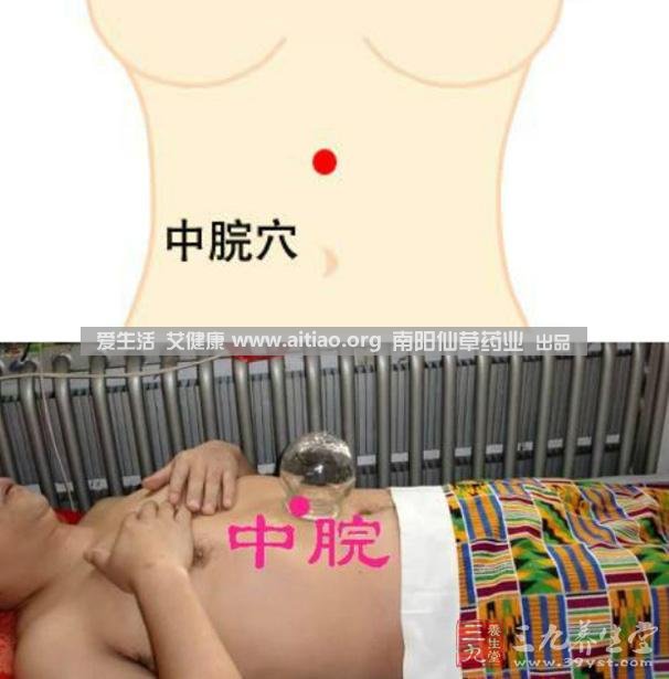 中脘穴位于腹部正中線(xiàn)，臍上4寸的位置上。每天艾灸10-15分鐘，能有效緩解胃部不適的癥狀，同時(shí)有助于祛濕。